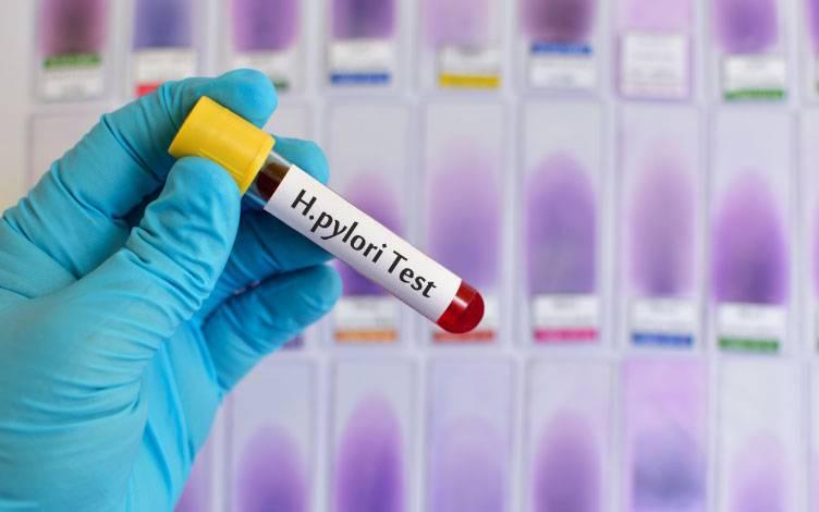 Helicobacter pylori: Una intrusa en el estómago