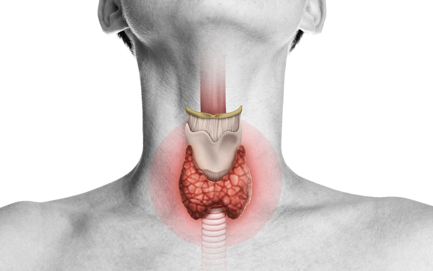Señales del cáncer de tiroides