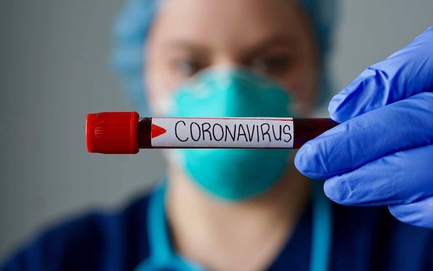 Razones para no alarmarse por el coronavirus