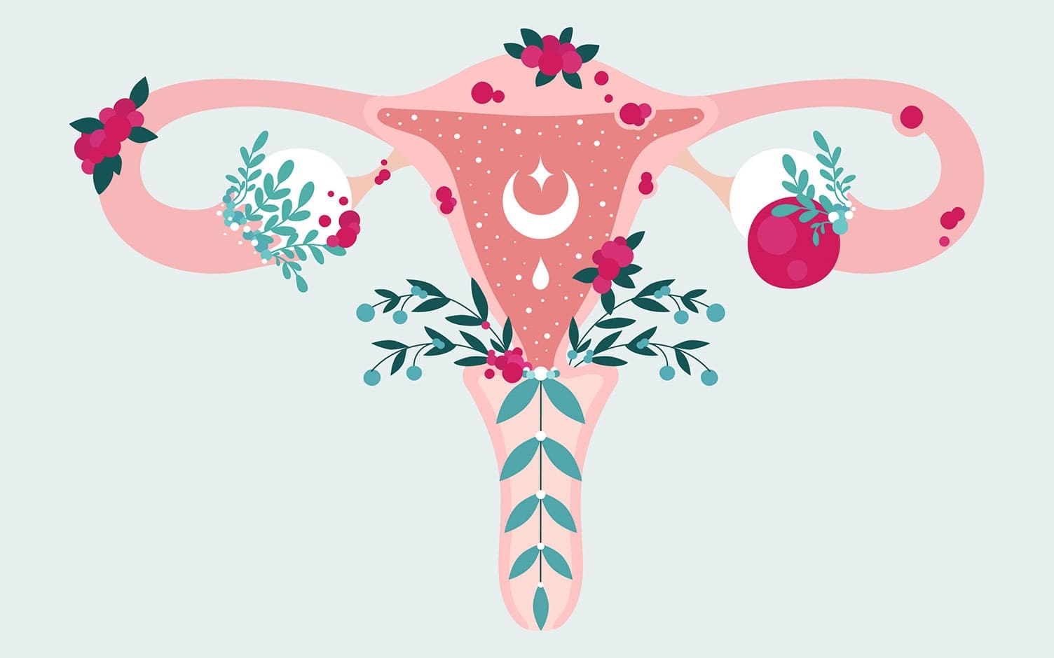 Cinco datos que debe saber sobre la endometriosis